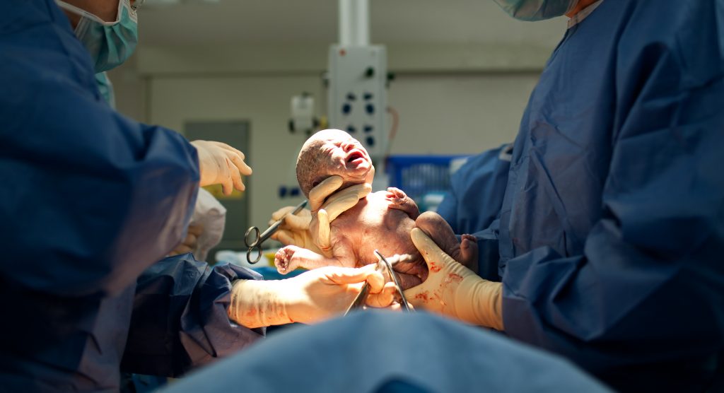 Baby being born